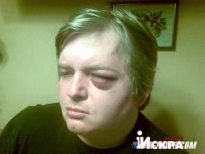 В Харькове жестоко избили активиста евромайдана