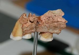 Человеческий зуб возрастом более 500 тысяч лет обнаружили во Франции