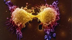 Cамоуничтожающая генотерапия эффективна против рака простаты