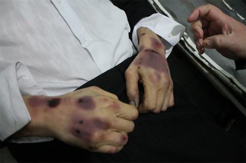 Пытки в застенках одесского Гестапо дошли до ООН