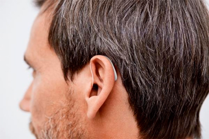 Слуховые аппараты — 4 вида конструкций, которые вам предложат в Центре Слуха «Simerex»